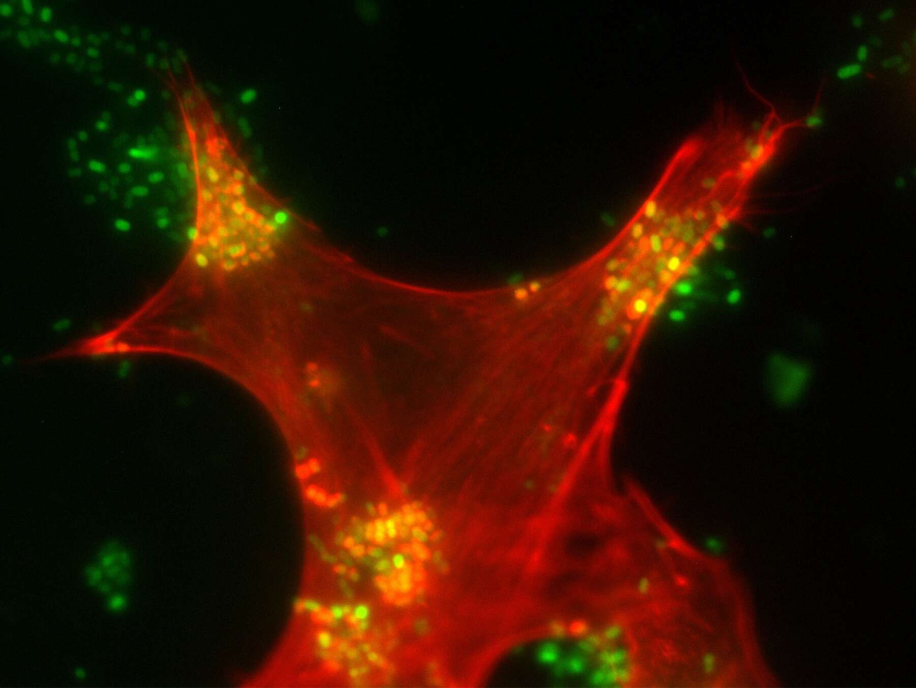 Enteropathogenic Escherichia coli (Green) attached the host cell to manipulate the actin cytoskeleton (Red) and promote formation of actin pedestals. 